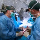 Dott. Jacopo Lenzi (sinistra) e dott. Antonio Nardone (destra) al microscopio operatorio